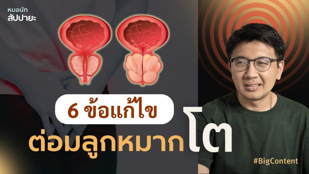2025 04 27 ต่อมลูกหมากโต 1024x576